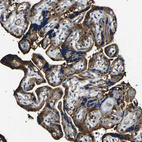 Immunohistochemical staining of human placenta shows cytoplasmic positivity in trophoblastic cells.