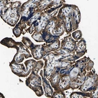 Immunohistochemical staining of human placenta shows cytoplasmic positivity in trophoblastic cells.