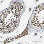 Immunohistochemical staining of human testis shows cytoplasmic positivity.