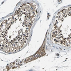 Immunohistochemical staining of human testis shows cytoplasmic positivity.