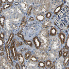 Immunohistochemical staining of human kidney shows cytoplasmic positivity in cells in tubules.
