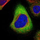 Immunofluorescent staining of human cell line A-431 shows localization to cytosol.