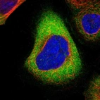 Immunofluorescent staining of human cell line A-431 shows localization to cytosol.