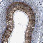 Anti-PTRH2 Antibody