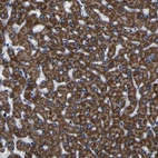 Immunohistochemical staining of human liver shows strong granular cytoplasmic positivity in hepatocytes.