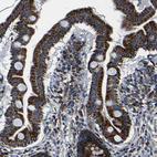 Anti-PTRH2 Antibody