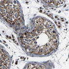 Anti-PTRH2 Antibody