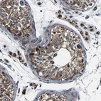 Immunohistochemical staining of human testis shows strong granular cytoplasmic positivity in cells in seminiferous ducts.