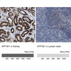 Anti-ATP1B1 Antibody