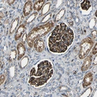 Anti-IGSF10 Antibody
