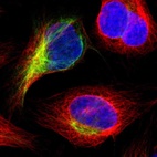 Immunofluorescent staining of human cell line U-2 OS shows localization to intermediate filaments.