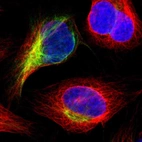Immunofluorescent staining of human cell line U-2 OS shows localization to intermediate filaments.