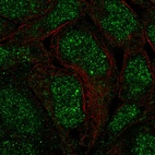 Immunofluorescent staining of human cell line RT4 shows localization to nucleus.