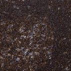 Immunohistochemical staining of human lymph node shows strong membranous positivity in lymphoid cells.