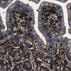 Immunohistochemical staining of human small intestine shows strong membranous positivity in lymphoid cells.