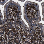 Immunohistochemical staining of human small intestine shows strong membranous positivity in lymphoid cells.
