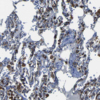 Immunohistochemical staining of human lung shows strong cytoplasmic and membranous positivity in macrophages.