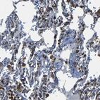 Immunohistochemical staining of human lung shows strong cytoplasmic and membranous positivity in macrophages.