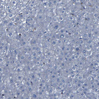 Immunohistochemical staining of human liver shows no positivity in hepatocytes as expected.
