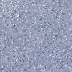 Immunohistochemical staining of human liver shows no positivity in hepatocytes as expected.