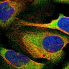 Immunofluorescent staining of human cell line U-2 OS shows localization to plasma membrane & cytosol.