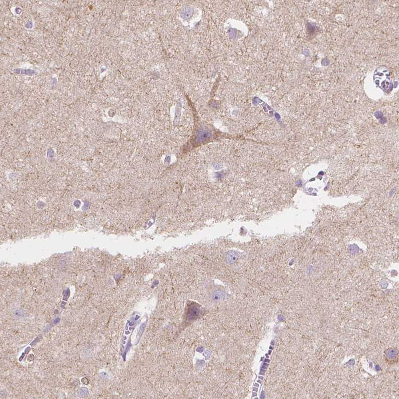 Anti-TMEM130 Antibody