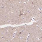 Anti-TMEM130 Antibody