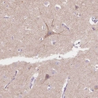 Anti-TMEM130 Antibody