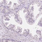 Immunohistochemical staining of human prostate shows no positivity in glandular cells as expected.