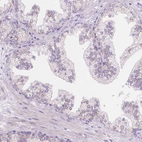 Immunohistochemical staining of human prostate shows no positivity in glandular cells as expected.