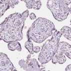 Immunohistochemical staining of human placenta shows no positivity in trophoblastic cells as expected.