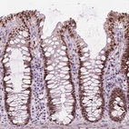 Anti-ISLR2 Antibody