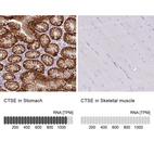 Anti-CTSE Antibody