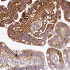 Immunohistochemical staining of human small intestine shows strong cytoplasmic positivity in glandular cells.