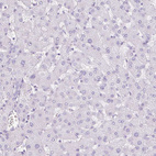 Immunohistochemical staining of human liver shows no positivity in hepatocytes as expected.