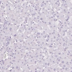 Immunohistochemical staining of human liver shows no positivity in hepatocytes as expected.