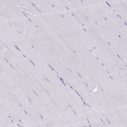 Immunohistochemical staining of human skeletal muscle shows no positivity in myocytes as expected.