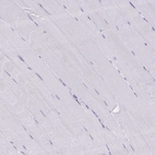 Immunohistochemical staining of human skeletal muscle shows no positivity in myocytes as expected.