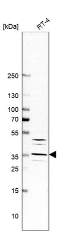 Western blot analysis in human cell line RT-4.