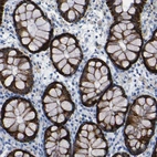 Immunohistochemical staining of human colon shows strong cytoplasmic positivity in glandular cells.