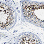 Immunohistochemical staining of human testis shows strong cytoplasmic positivity in cells in seminiferous ducts.