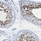 Immunohistochemical staining of human testis shows strong cytoplasmic positivity in cells in seminiferous ducts.