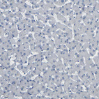 Immunohistochemical staining of human liver shows no positivity in hepatocytes as expected.
