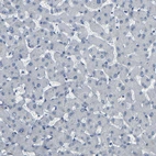 Immunohistochemical staining of human liver shows no positivity in hepatocytes as expected.