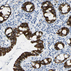 Immunohistochemical staining of human rectum shows strong cytoplasmic positivity in glandular cells.