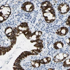 Immunohistochemical staining of human rectum shows strong cytoplasmic positivity in glandular cells.