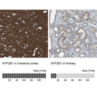 Anti-ATP2B1 Antibody