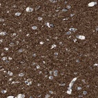 Immunohistochemical staining of human cerebral cortex shows high expression.