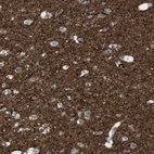 Immunohistochemical staining of human cerebral cortex shows high expression.