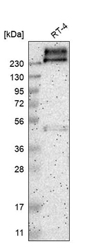 Western blot analysis in human cell line RT-4.